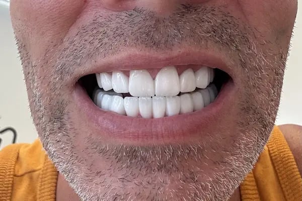 Dentakay Dental Clinic Antalya - Resim 7