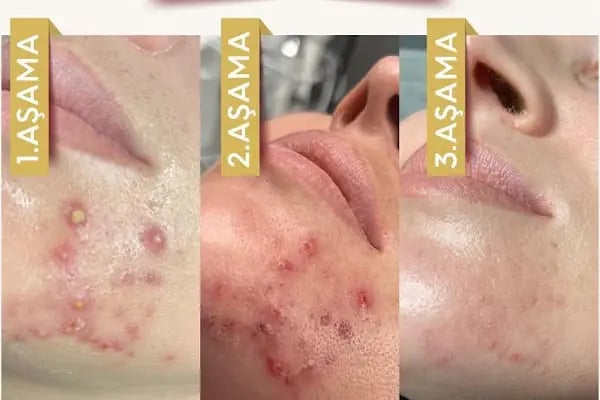 Nurdan Yenici Beauty Center - Resim 19
