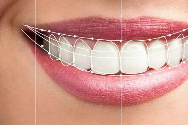 ANDEPOL - Antalya Dental Polyclinic - Resim 8