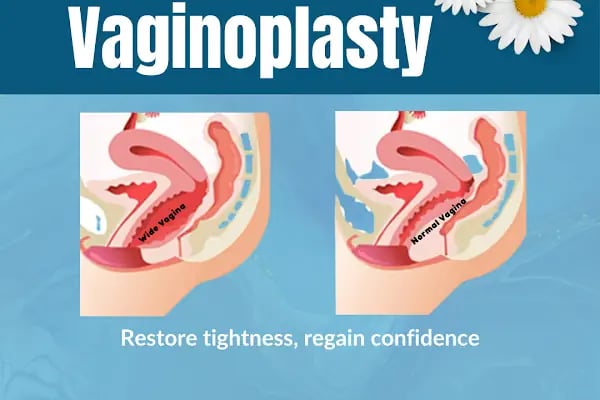 Dr.Adem Özden - Labiaplasty | Vaginoplasty | Laser Vaginal Rejuvenation | Hymenoplasty | O-Shot | Genital Aesthetics - Resim 19