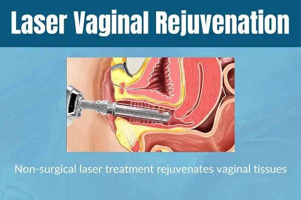Dr.Adem Özden - Labiaplasty | Vaginoplasty | Laser Vaginal Rejuvenation | Hymenoplasty | O-Shot | Genital Aesthetics - Resim 13
