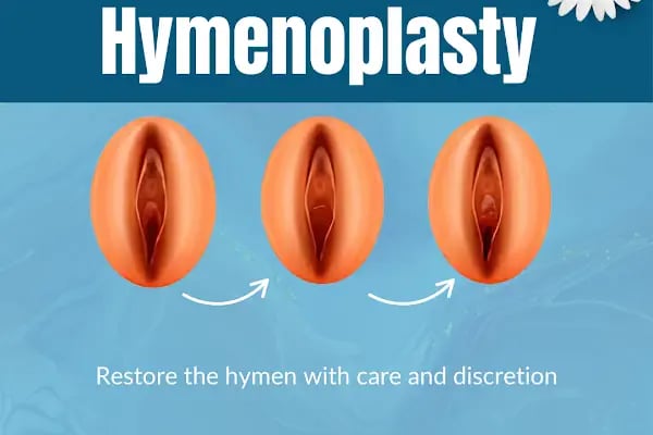 Dr.Adem Özden - Labiaplasty | Vaginoplasty | Laser Vaginal Rejuvenation | Hymenoplasty | O-Shot | Genital Aesthetics - Resim 18