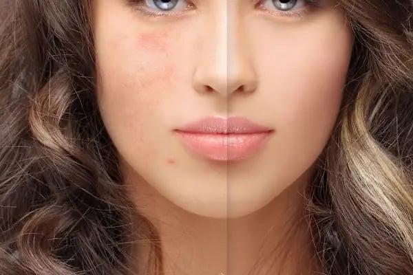 Viproyal Beauty - Resim 11