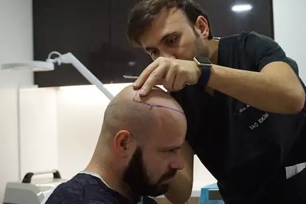 Capillum Clinic Saç Ekimi ve Saç Sağlığı Merkezi - Resim 20