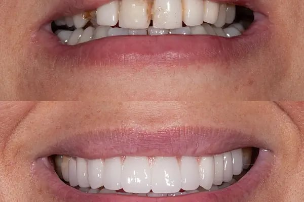 Artı Klinik Ağız ve Diş Sağlığı Polikliniği - Yeni Batı Diş Kliniği - Resim 18