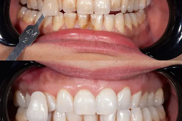 Artı Klinik Ağız ve Diş Sağlığı Polikliniği - Yeni Batı Diş Kliniği - Resim 16