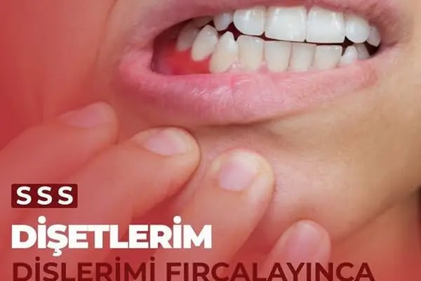 Kuru Clinic Dental Health Polyclinic Turkey - Resim 17