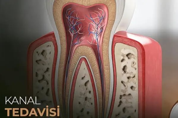 Kuru Clinic Dental Health Polyclinic Turkey - Resim 10