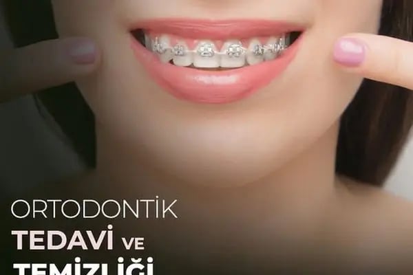 Kuru Clinic Dental Health Polyclinic Turkey - Resim 16