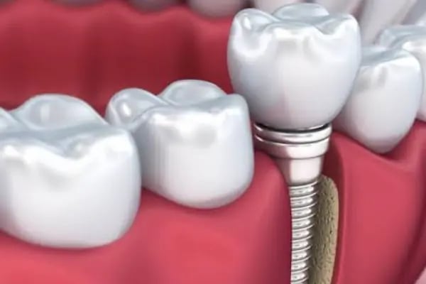 Uğurlu Dental Ağız ve Diş Sağlığı Polikliniği - Resim 5