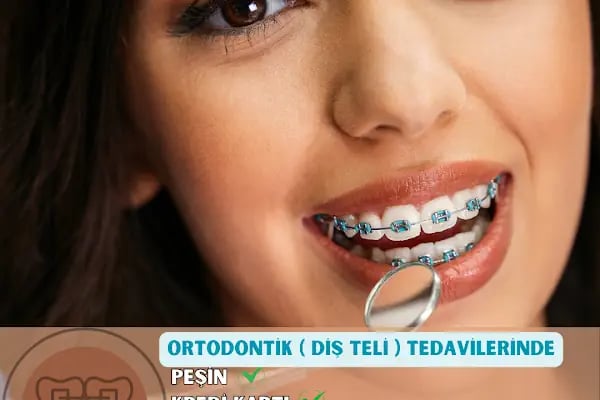 Özel 34 Ağız ve Diş Sağlığı Polikliniği | Avcılar Diş Hekimi | Diş Polikliniği | İmplant Tedavisi | Zirkonyum Kaplama - Resim 7