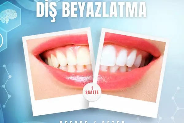 Özel 34 Ağız ve Diş Sağlığı Polikliniği | Avcılar Diş Hekimi | Diş Polikliniği | İmplant Tedavisi | Zirkonyum Kaplama - Resim 3