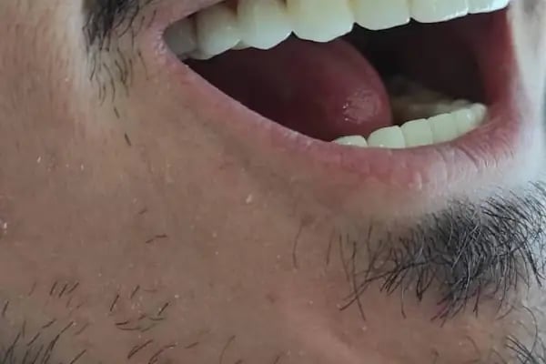 Özel Eryaman Dentestetik Ağız ve Diş Sağlığı Polikliniği - Resim 19