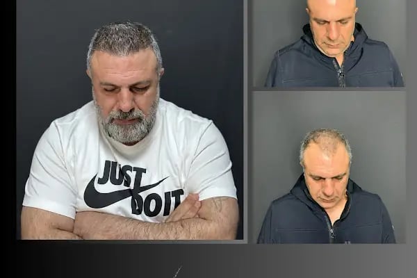 Ömer Uğur Saç Ekim - Resim 17