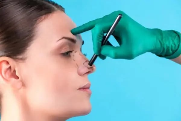 Op.Dr.Evren Ay Koç Rhinoplasty - Burun Estetiği - Resim 20