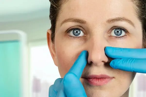 Op.Dr.Evren Ay Koç Rhinoplasty - Burun Estetiği - Resim 7