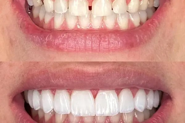 Arzu Sarıyıldız Turgutreis Bodrum Diş Kliniği | İmplant ve Dental Estetik Diş Kliniği - Resim 1