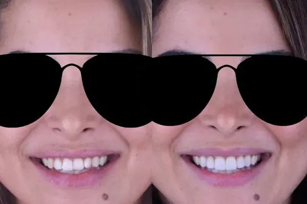 Arzu Sarıyıldız Turgutreis Bodrum Diş Kliniği | İmplant ve Dental Estetik Diş Kliniği - Resim 19