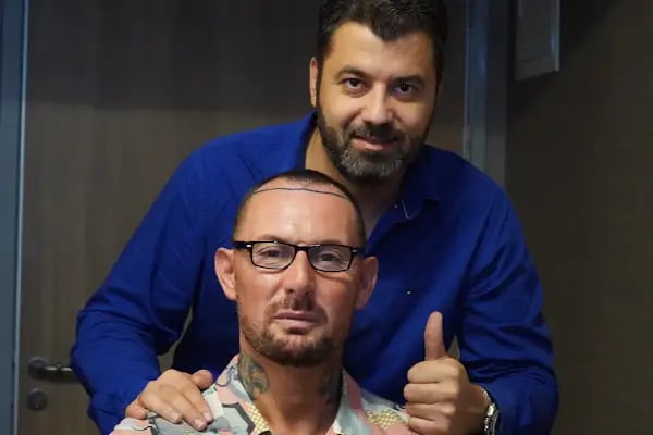 ESTHETICANA - Exclusive Hair Transplant in Turkey - Resim 20