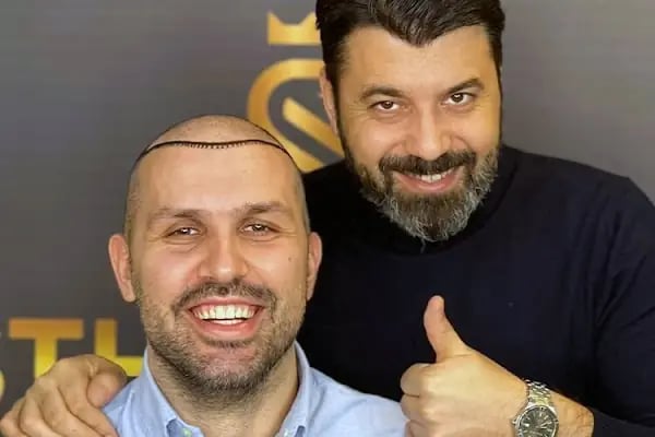 ESTHETICANA - Exclusive Hair Transplant in Turkey - Resim 19