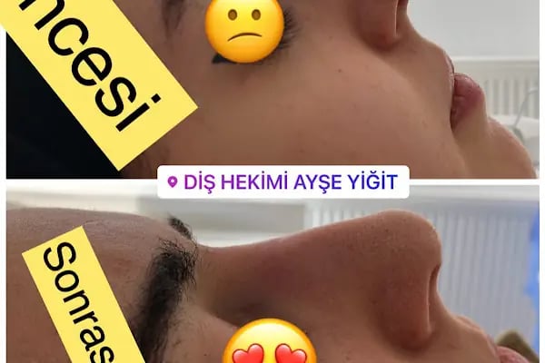 Diş hekimi Ayşe yiğit - Resim 7