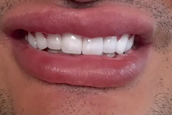 Özel DENTAL Boutique Ağız ve Diş Sağlığı Polikliniği - Resim 8