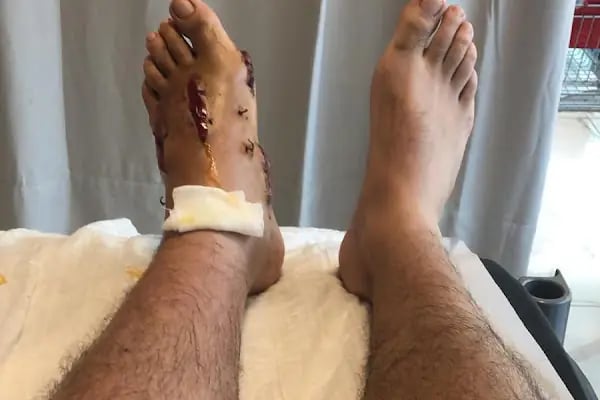 Op. Dr. Atakan Ezici | Ortopedi Operatör Doktor | Ortopedik Cerrah - Resim 9
