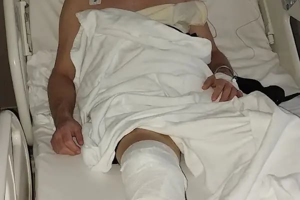 Op. Dr. Atakan Ezici | Ortopedi Operatör Doktor | Ortopedik Cerrah - Resim 11
