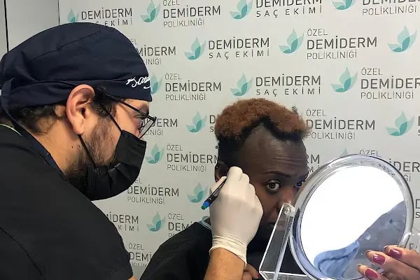 Özel Demiderm Saç Ekimi - Resim 9