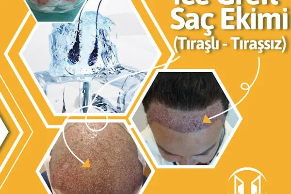 Özel History Clinic Polikliniği | Hair Transplant Clinic in Turkey - Resim 18