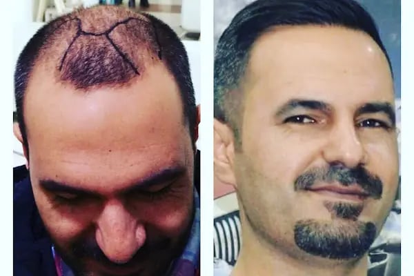 Hollywood Hair Center - Resim 16