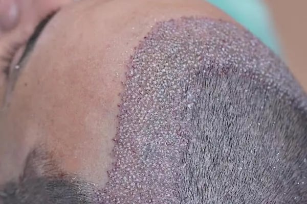 Hollywood Hair Center - Resim 20