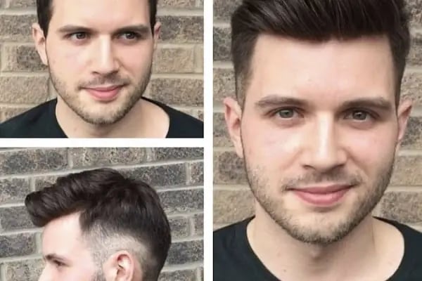 Hollywood Hair Center - Resim 12