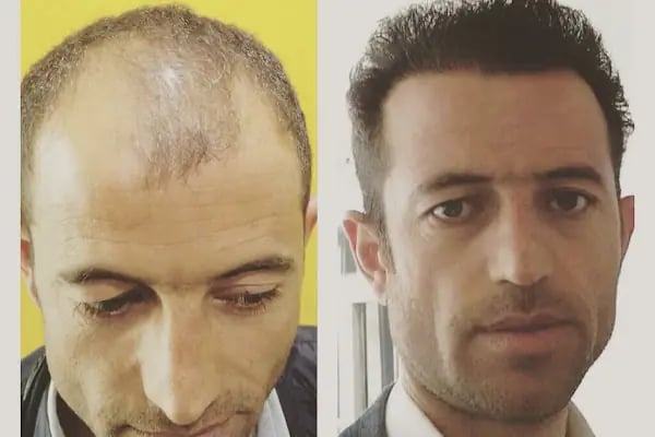 Hollywood Hair Center - Resim 9