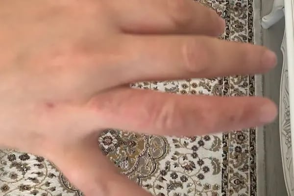 Yasemin'in Güzellik Salonu | BAĞLICA | Microblading-Cilt Bakımı-Bölgesel Zayıflama-Kalıcı Makyaj-Buz Başlıklı Lazer-Tırnak - Resim 12