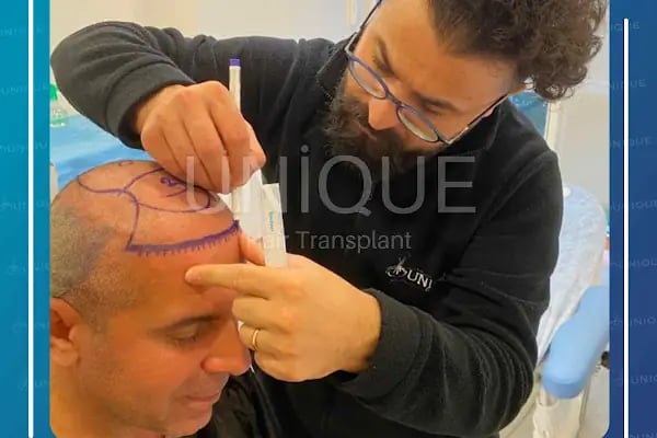Unique Hair Transplant - Resim 18