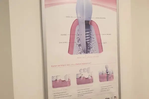 Diş Hekimi Kadir Süzer - Resim 6