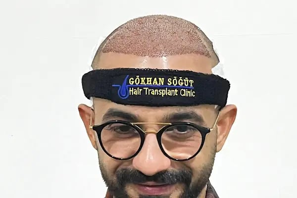 Gökhan Hair Clinic - Malatya Saç Ekim Merkezi - Resim 4