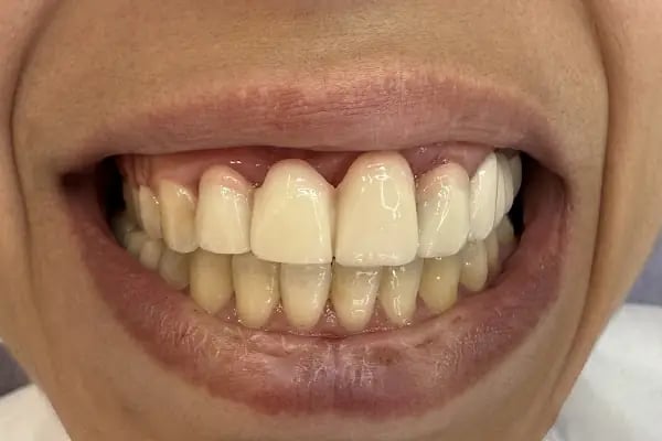 Dentalizm Aliağa Ağız ve Diş Sağlığı Polikliniği - Resim 4