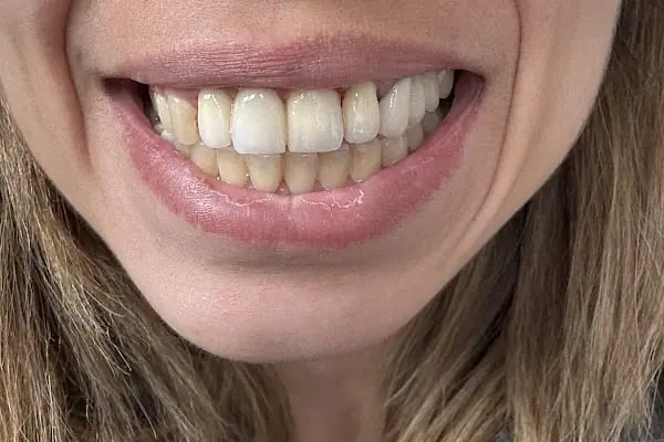 Dentalizm Aliağa Ağız ve Diş Sağlığı Polikliniği - Resim 11
