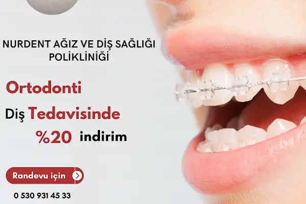 GÜRSU ÖZEL NURDENT AĞIZ VE DİŞ SAĞLIĞI POLİKLİNİĞİ - Resim 8