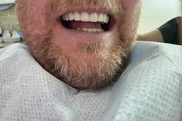 Alanya Dental Center - Özel Alanya Ağız Ve Diş Sağlığı Polikliniği - Resim 8