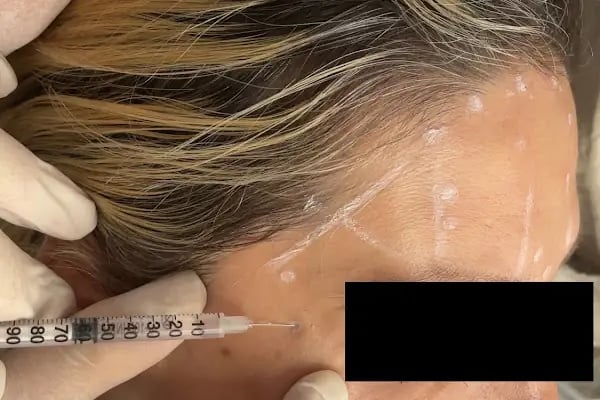 Özel Smile Center Van Ağız ve Diş sağlığı polikliniği - Resim 8