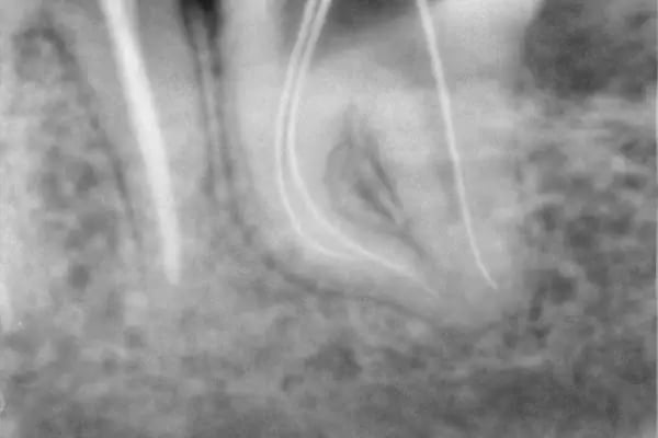 Özel Smile Center Van Ağız ve Diş sağlığı polikliniği - Resim 2