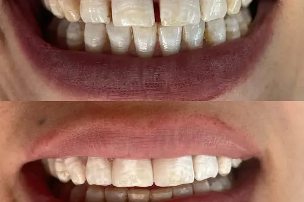 Özel Smile Center Van Ağız ve Diş sağlığı polikliniği - Resim 6