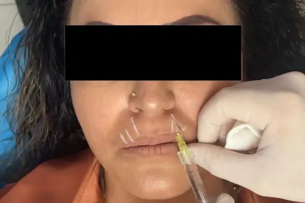 Özel Smile Center Van Ağız ve Diş sağlığı polikliniği - Resim 10