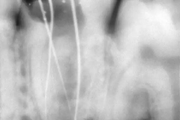 Özel Smile Center Van Ağız ve Diş sağlığı polikliniği - Resim 20