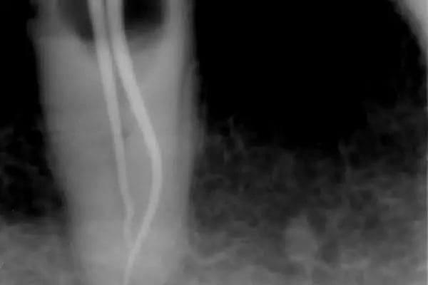 Özel Smile Center Van Ağız ve Diş sağlığı polikliniği - Resim 13