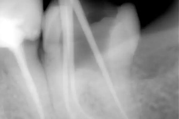 Özel Smile Center Van Ağız ve Diş sağlığı polikliniği - Resim 17