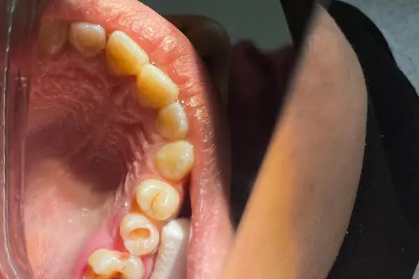 Özel Smile Center Van Ağız ve Diş sağlığı polikliniği - Resim 11
